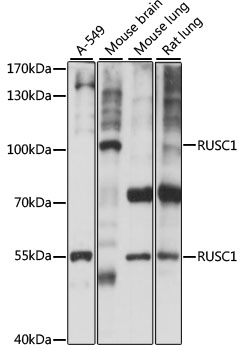 Anti-RUSC1 Antibody (CAB15417)