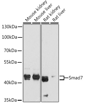 Anti-Smad7 Antibody (CAB12343)