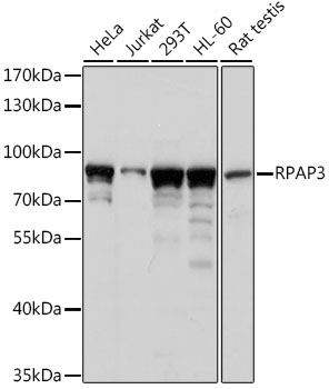 Anti-RPAP3 Antibody (CAB15239)