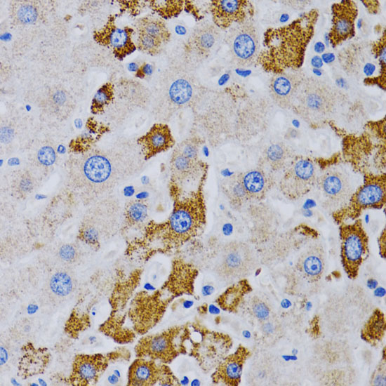 Anti-CYP24A1 Antibody (CAB1805)