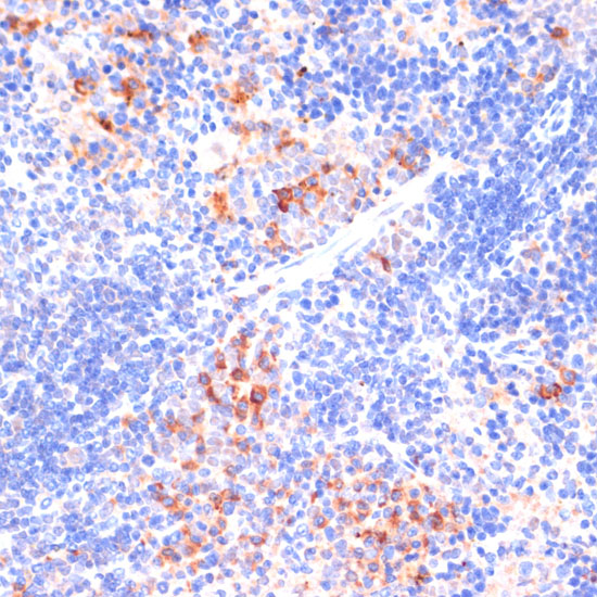 Anti-ARRB1 Antibody (CAB0998)