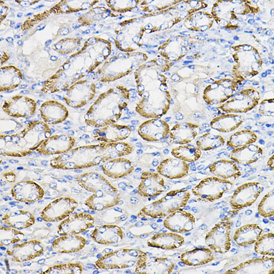 Anti-NUBP1 Antibody (CAB16403)