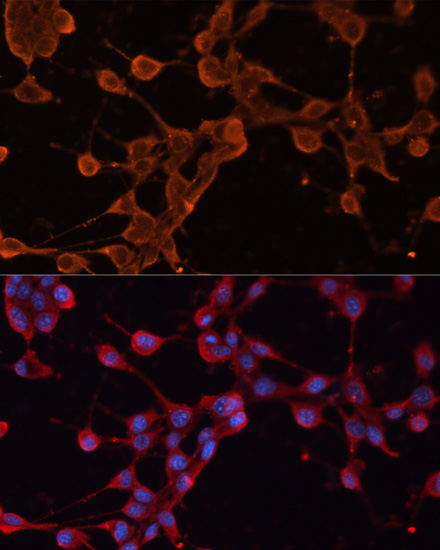 Anti-ABCB11 Antibody (CAB14694)