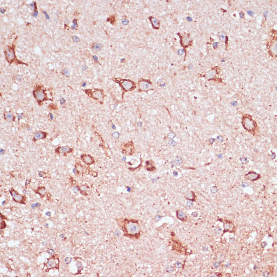 Anti-ENTPD6 Antibody (CAB15655)