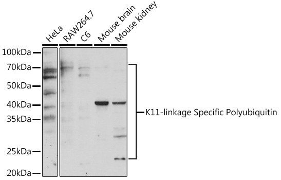 Anti-K11-linkage Specific Polyubiquitin Antibody (CAB18197)