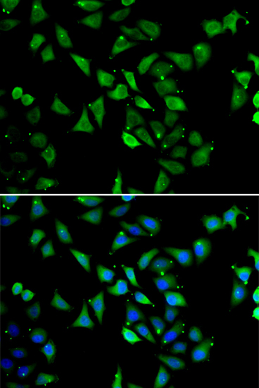 Anti-EIF3C Antibody (CAB7022)