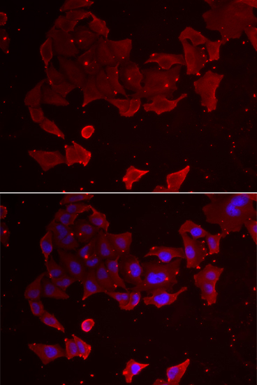 Anti-FLCN Antibody (CAB6493)