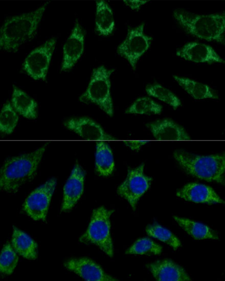 Anti-ETFB Antibody (CAB16043)