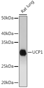 Anti-UCP1 Antibody (CAB5857)