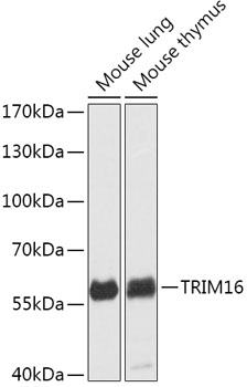 Anti-TRIM16 Antibody (CAB17619)