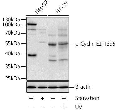 Anti-Phospho-CCNE1-T395 Antibody (CABP0013)