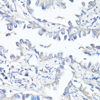 Anti-P Glycoprotein Antibody (CAB11758)