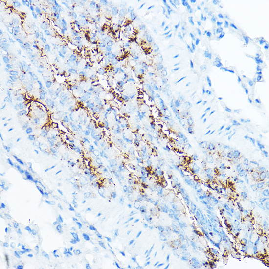 Anti-TMPRSS2 Antibody (CAB1979)