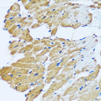 Anti-ARHGEF5 Antibody (CAB17014)