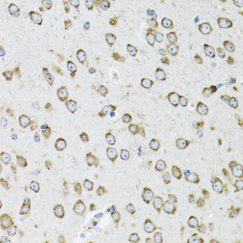 Anti-OGDH Antibody (CAB12477)