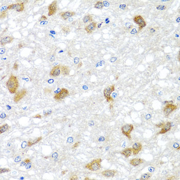 Anti-PIP4K2B Polyclonal Antibody (CAB8016)