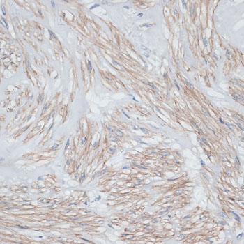 Anti-TPM1 Antibody (CAB1157)