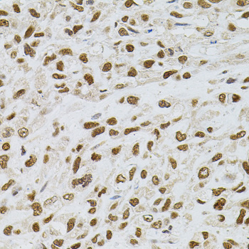 Anti-TGM2 Antibody (CAB0981)