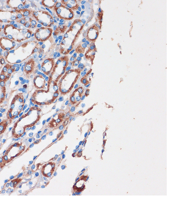 Anti-CHDH Antibody (CAB16545)