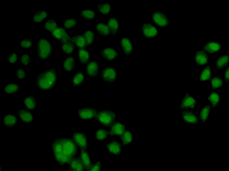 Anti-OAS1 Antibody (CAB2530)