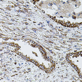 Anti-SHH Antibody (CAB12503)