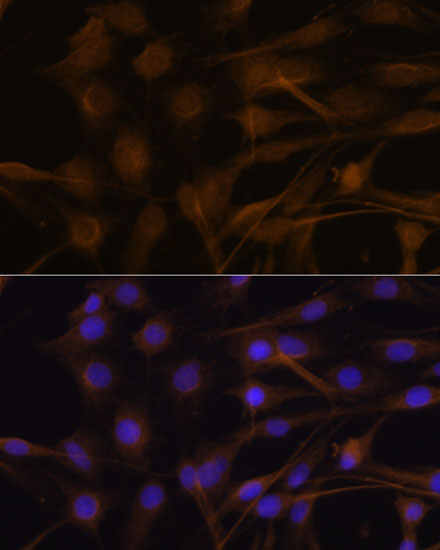 Anti-TIMP2 Antibody (CAB1558)