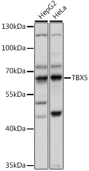 Anti-TBX5 Antibody (CAB15590)