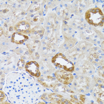 Anti-RNASEL Polyclonal Antibody (CAB9840)