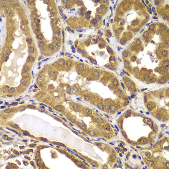 Anti-PSEN2 Antibody (CAB7719)