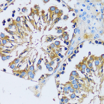 Anti-CABP7 Antibody (CAB13703)