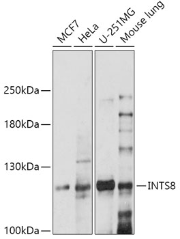 Anti-INTS8 Antibody (CAB17726)