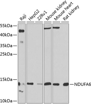 Anti-NDUFA6 Polyclonal Antibody (CAB9831)