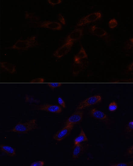 Anti-SHH Antibody (CAB7726)