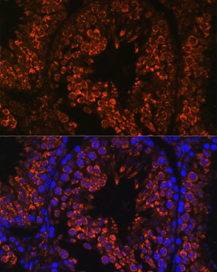 Anti-FER1L5 Antibody (CAB15926)