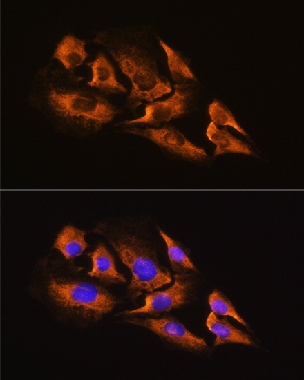 Anti-ADRA2A Antibody (CAB2809)