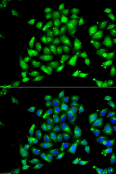 Anti-ARFGAP1 Antibody (CAB7118)