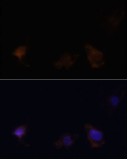 Anti-ZYX Antibody (CAB2135)