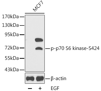 Anti-Phospho-RPS6KB1-S424 Antibody (CABP0253)