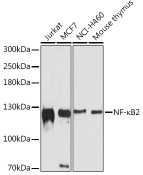 NF-kB2 Rabbit Polyclonal Antibody (CAB11163)