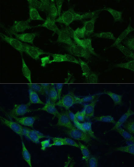 Anti-Bak Antibody (CAB13281)