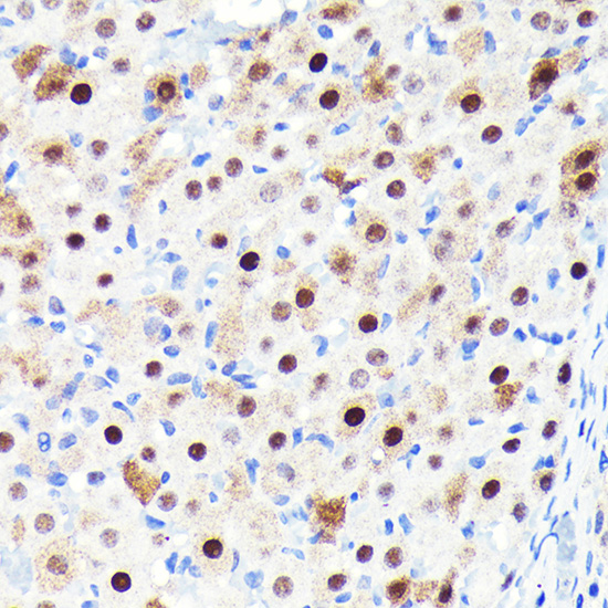 Anti-CDKN1B/p27KIP1 Antibody [KO Validated] (CAB19095)