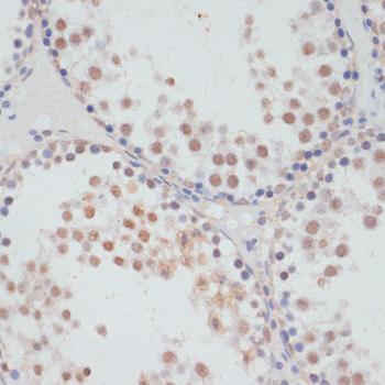 Anti-Phospho-RPS6KA5-S376 pAb (CABP0800)