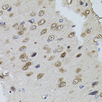 Anti-TRPC3 Antibody (CAB7742)