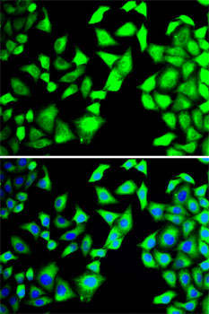 Anti-EIF3H Antibody (CAB13378)