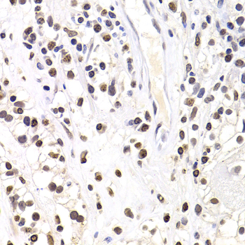 Anti-SOX5 Antibody (CAB6985)