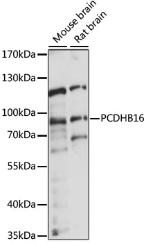 Anti-PCDHB16 Antibody (CAB15493)