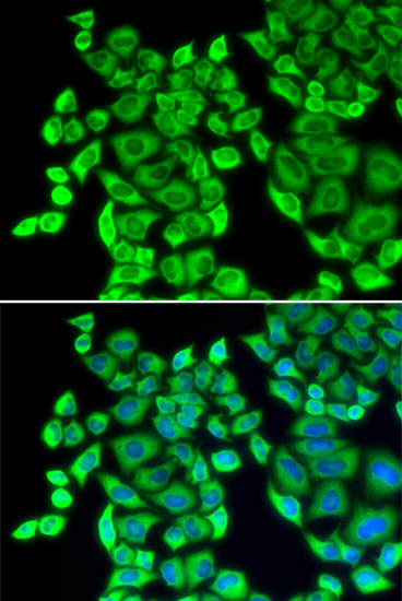 Anti-EEF1D Antibody (CAB2509)