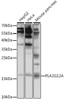 Anti-PLA2G12A Antibody (CAB15902)