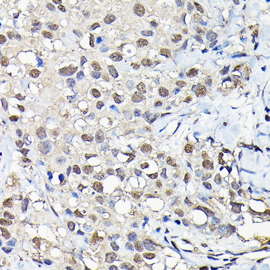 Anti-PFKFB3 Antibody (CAB6945)