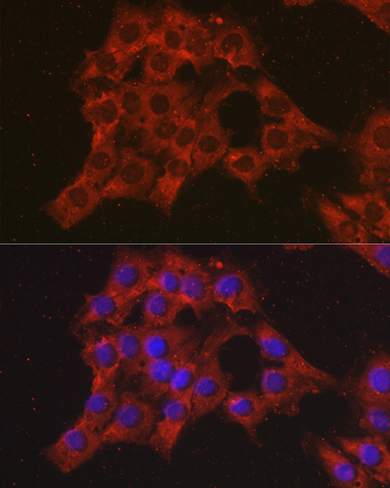 Anti-CCL3 Antibody (CAB7568)